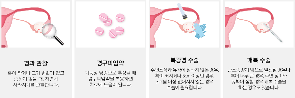 경과 관찰, 경구피임약, 복강경 수술, 개복 수술